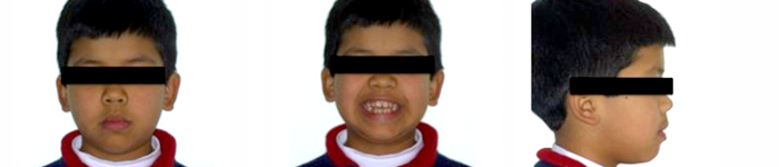 Caso ortodóncico 1