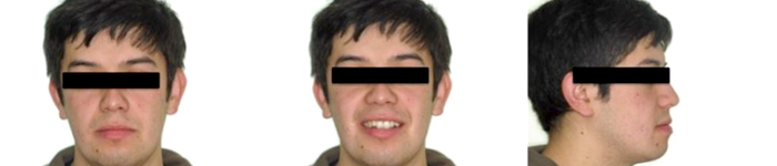 Caso ortodóncico 2