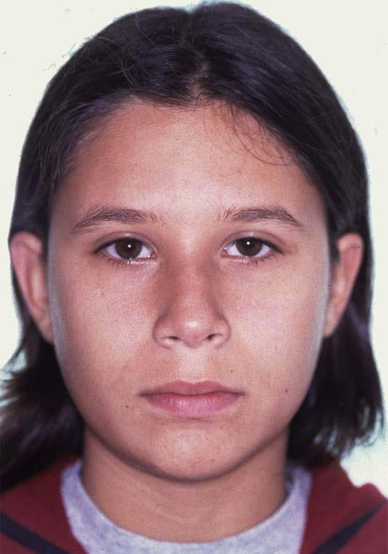 Caso 1 cara antes
