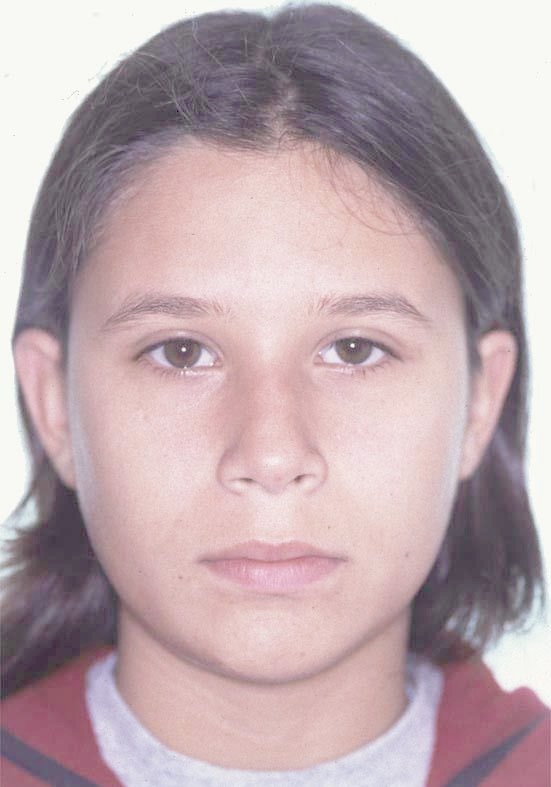 Caso 1 cara antes