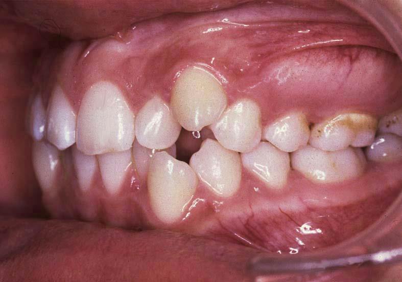 Caso 1 dental