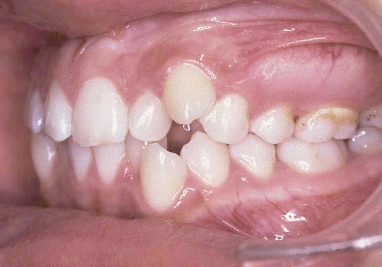 Caso 1 dental