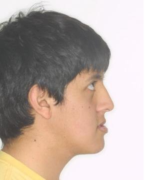 Caso 2 cara antes