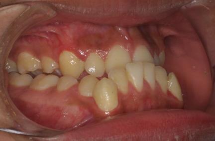 Caso 2 dental