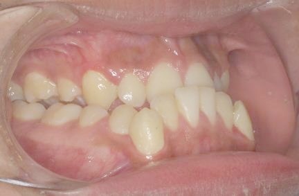 Caso 2 dental