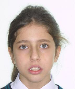 Caso 3 cara antes