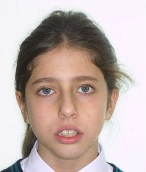 Caso 3 cara antes