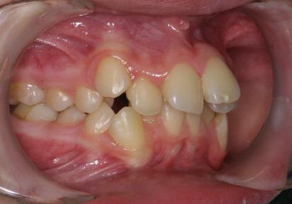 Caso 3 dental