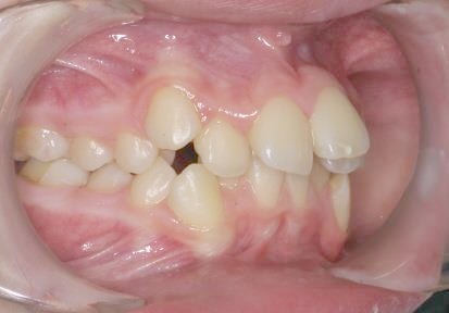 Caso 3 dental